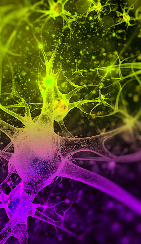 neuronenbild2 neuronenbild2